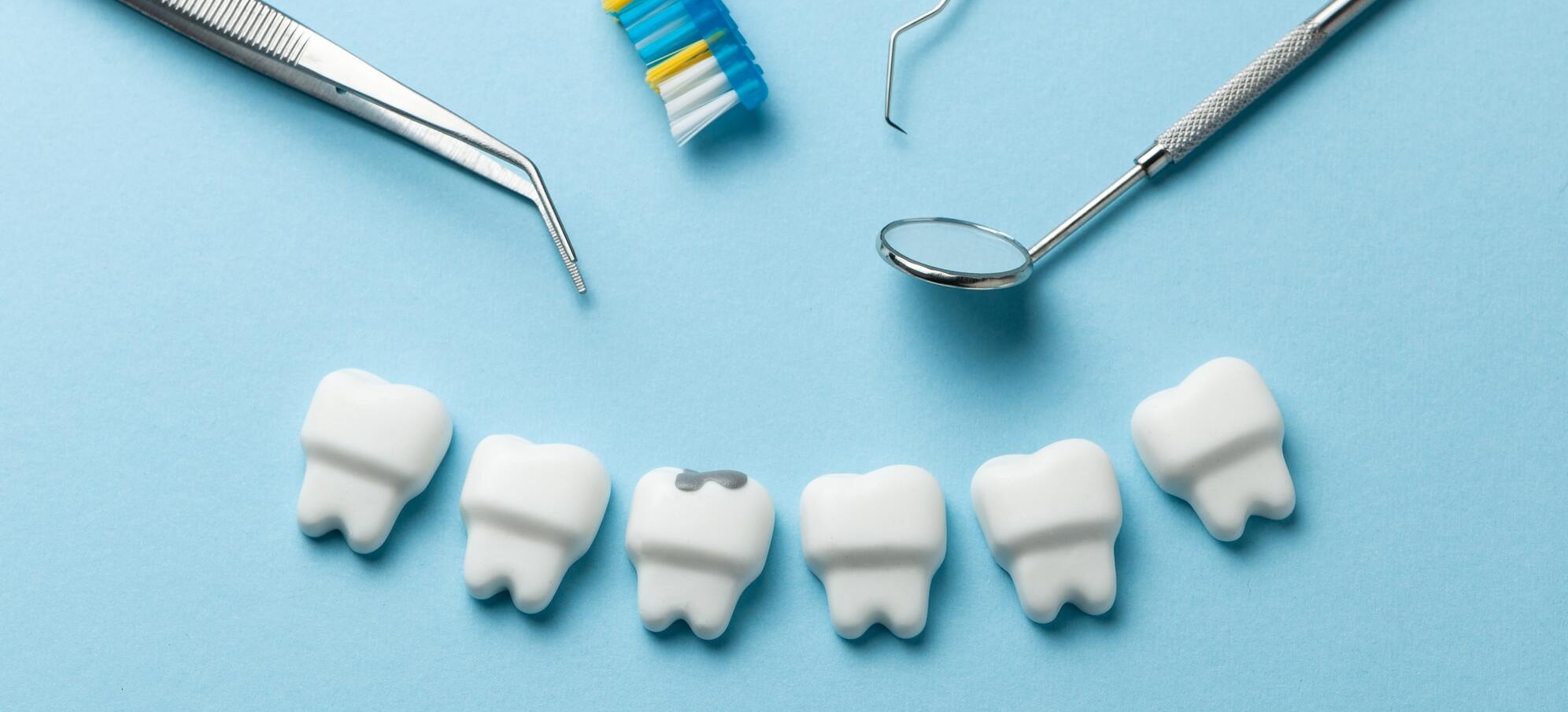 歯が痛くなる前の「予防治療」